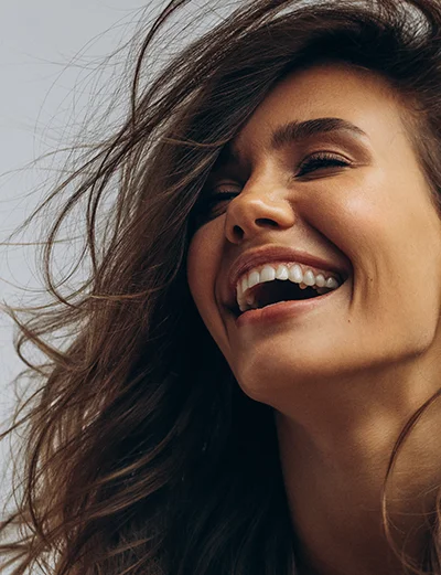 Woman's Big Smile Showing Dental Veneers