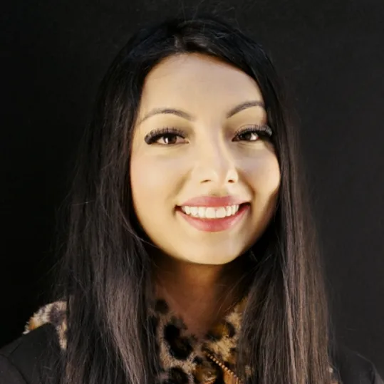 A real patient with No-Prep Composite Veneers treatment
